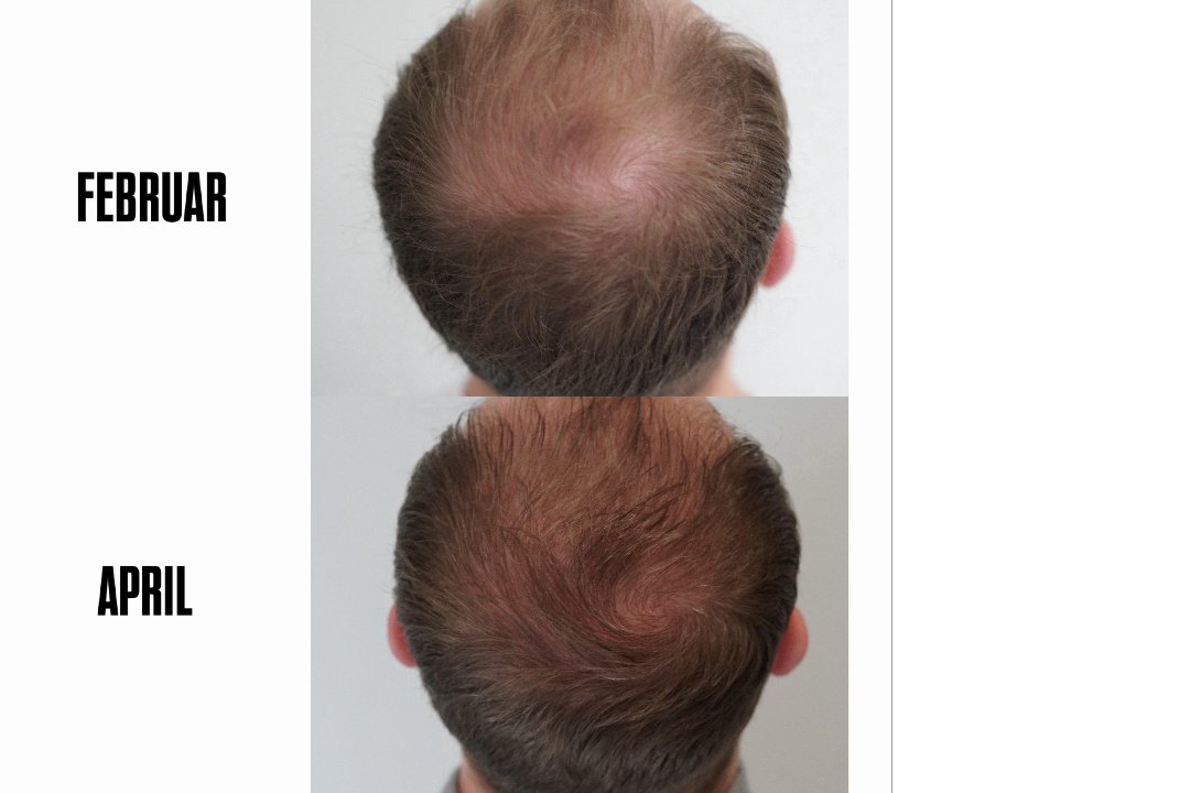 MSLY AESTHETICS STUTTGART, Rathaus, Stuttgart