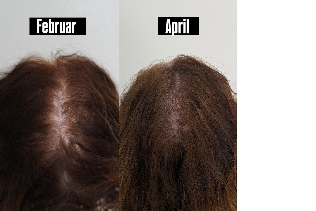 MSLY AESTHETICS STUTTGART, Rathaus, Stuttgart