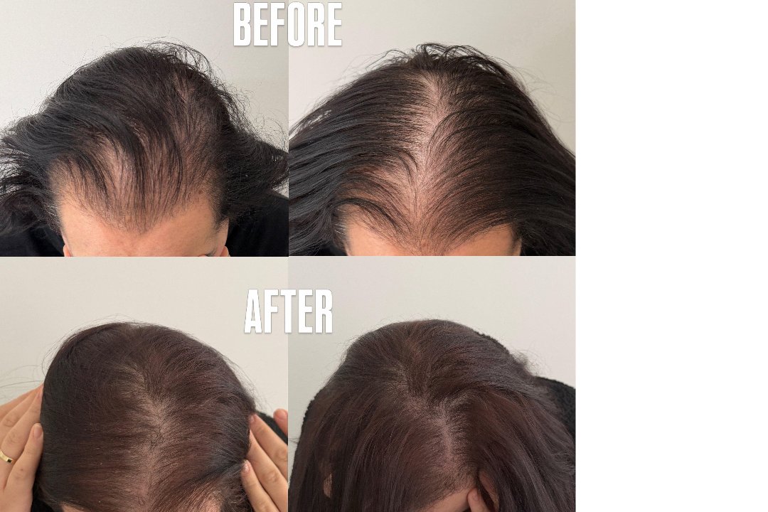 MSLY AESTHETICS STUTTGART, Rathaus, Stuttgart