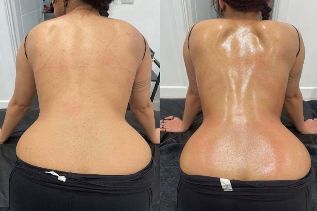 Relax Sculpt Recover, Shirley, Birmingham