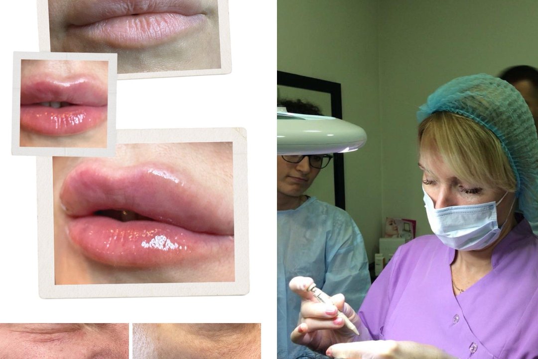 Amber Beautykrasa, The Cotswolds