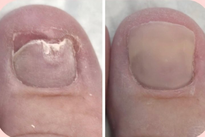 Bee You Nails - Onglerie Woolston - Photo de galerie - OneBooking