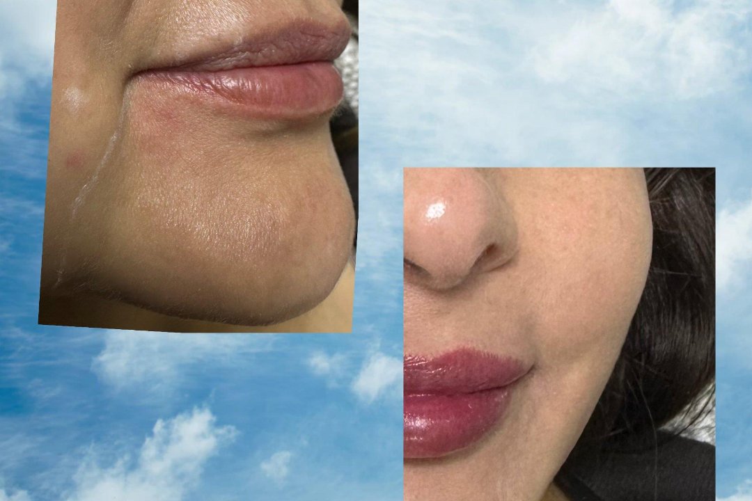 Advanced Aesthetic, Ealing Broadway, London