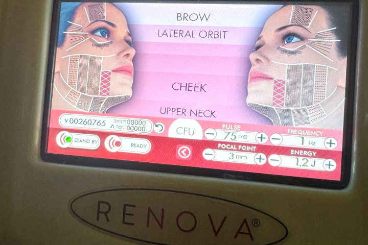 Allure Hair, Skin & Laser Treatment - Soin visage Moortown - Photo de galerie - OneBooking