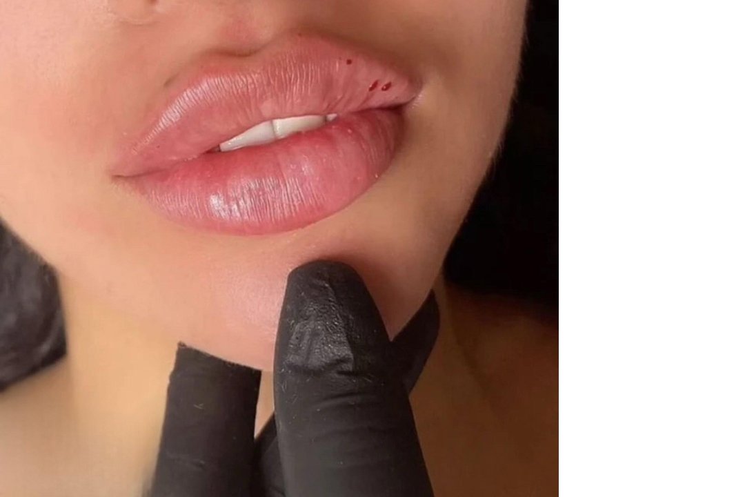French Kiss Salon. Aesthetic By Lilette, Blackheath, London