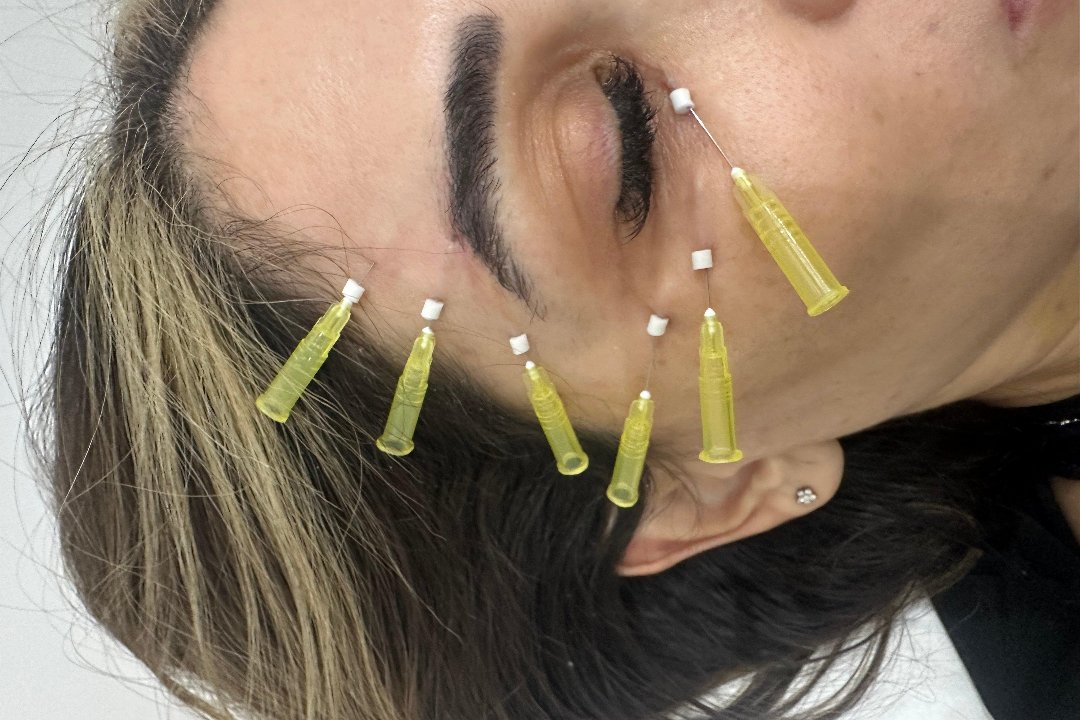 Aesthetic By Lilette, Sussex Square Gardens, London