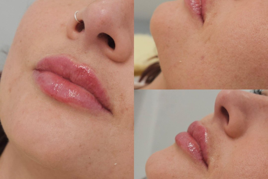 A2Zee Aesthetics, Trafford Park, Trafford