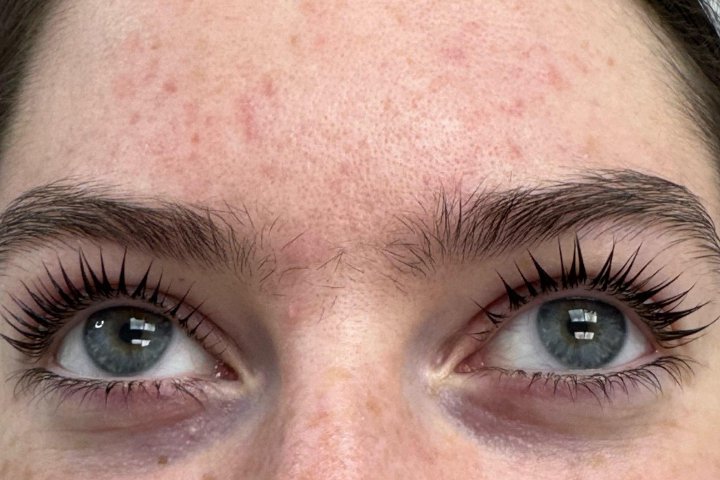 Allure Hair, Skin & Laser Treatment - Soin visage Moortown - Photo de galerie - OneBooking