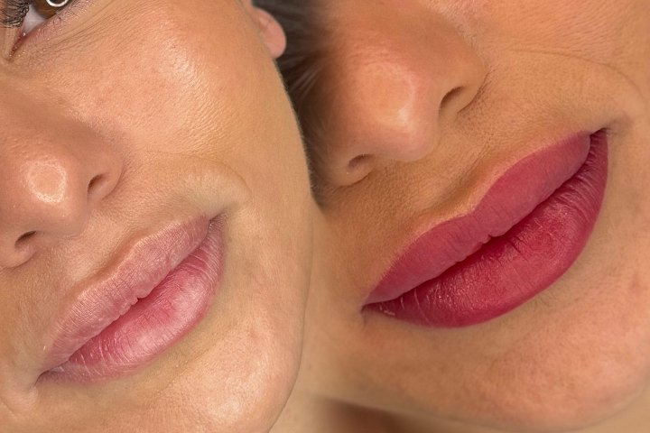 For Me Beauty Center - Onglerie Volla (NA) - Photo de galerie - OneBooking