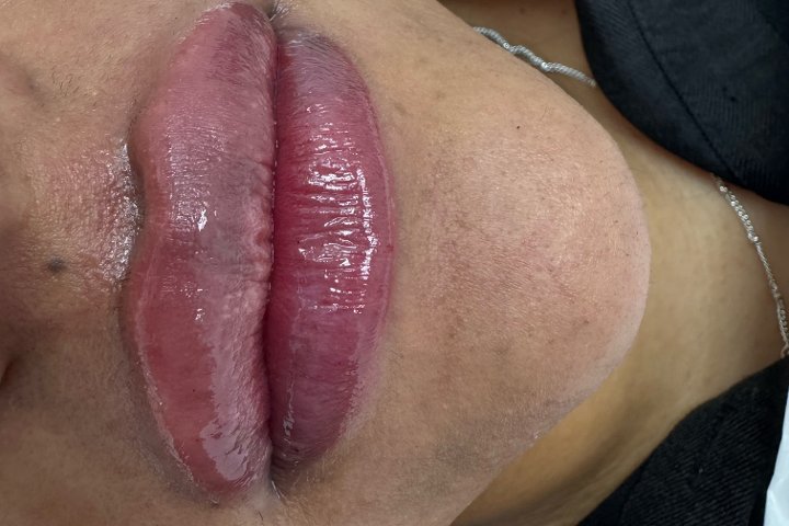 Allure Hair, Skin & Laser Treatment - Soin visage Moortown - Photo de galerie - OneBooking