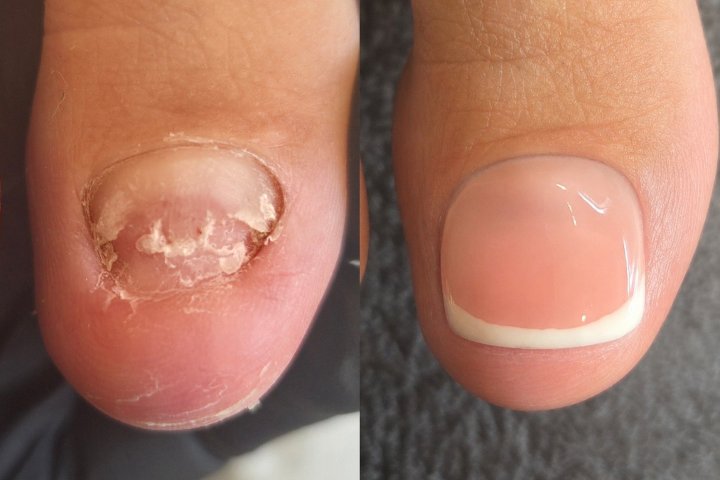 Bee You Nails - Onglerie Woolston - Photo de galerie - OneBooking