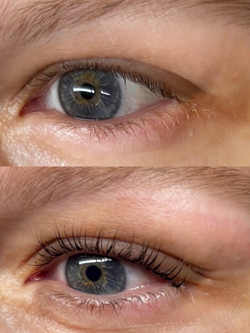 Aus Sarahs Behandlungs-Portfolio