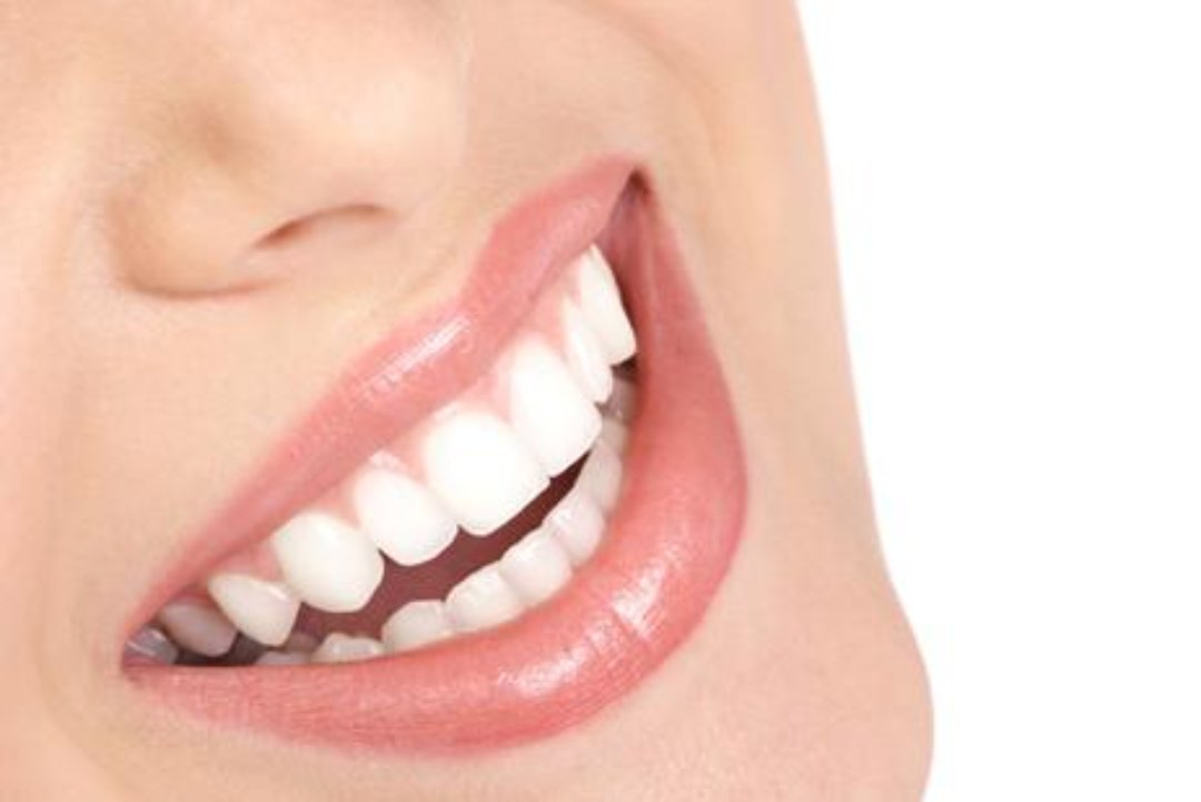 Hollywood Whitening Ilford, Goodmayes, London