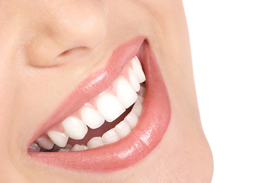 All White Glasgow, Blythswood, Glasgow