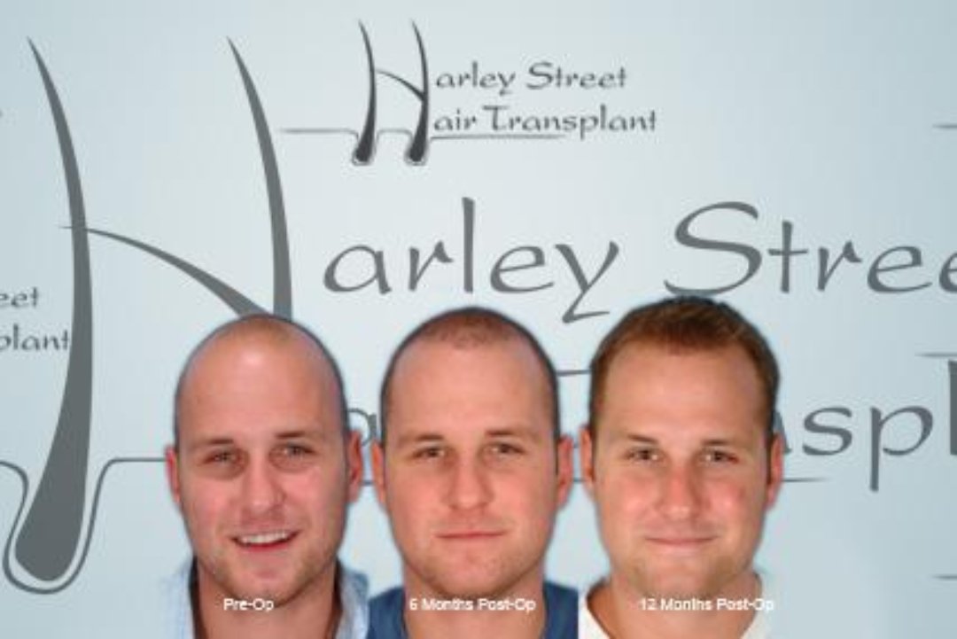 Harley Street Hair Transplant, Harley Street, London