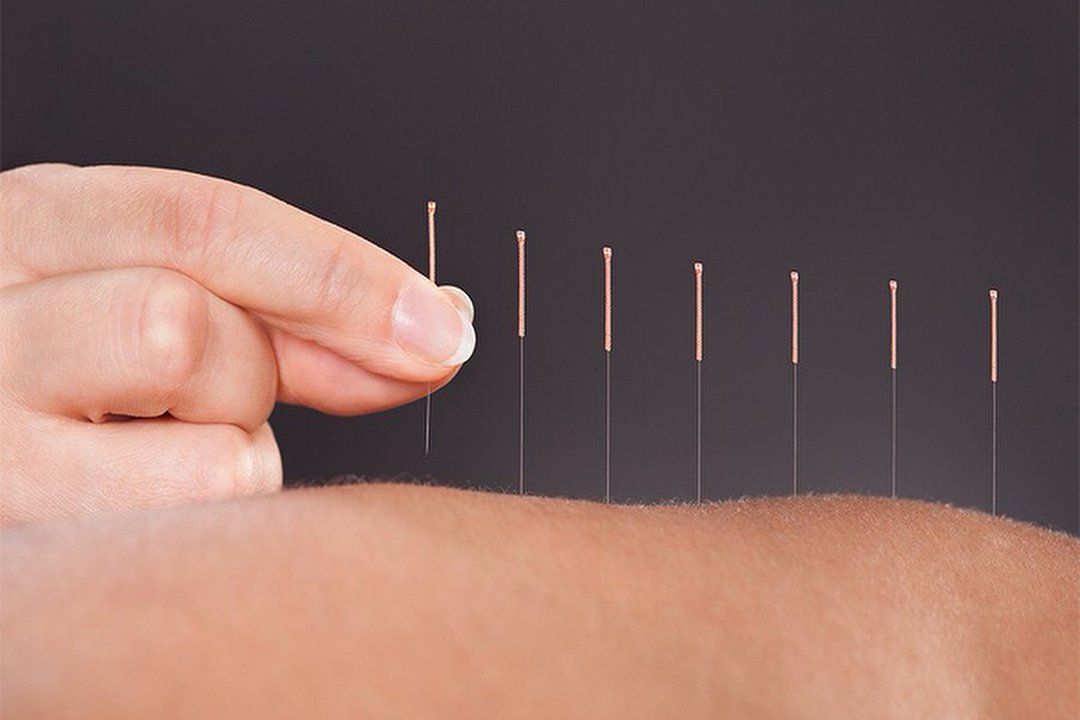 Dr Hu Acupuncture Centre, Cricklewood, London
