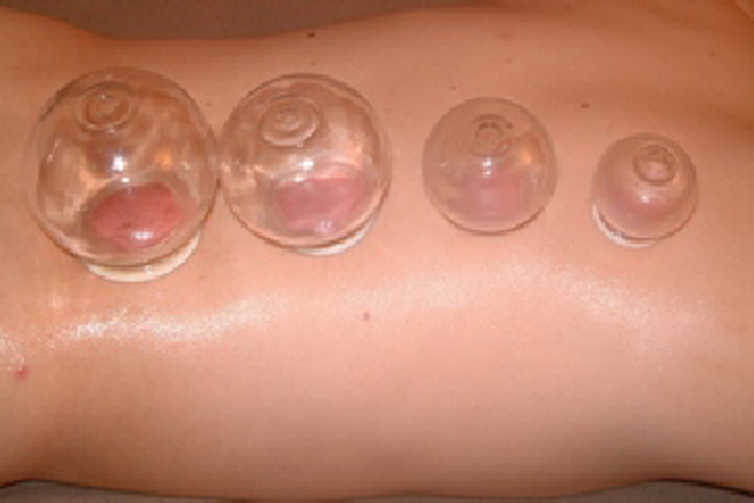 Vitality Acupuncture at Warren Street, Pimlico, London