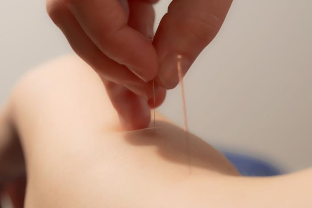 Swallow's Tail: Acupuncture and Massage, Great Portland Street, London