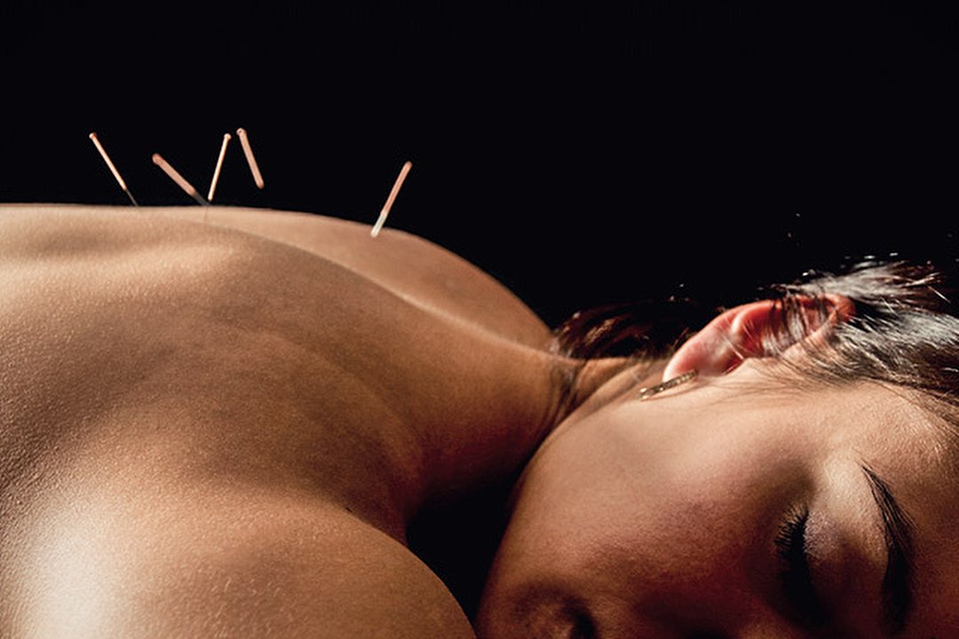 Hampshire Acupuncture at City Healing Pain Clinic, Southampton