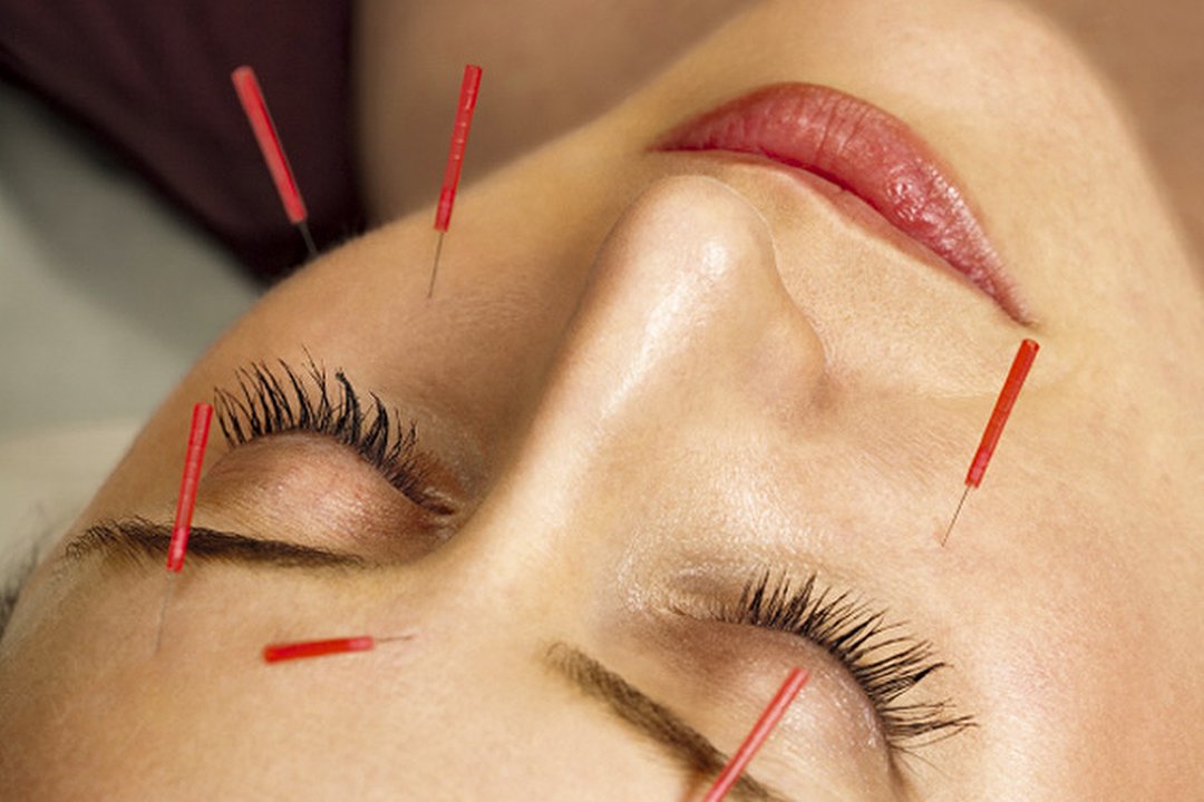 Hampshire Acupuncture Salon - Locks Heath, Locks Heath, Hampshire