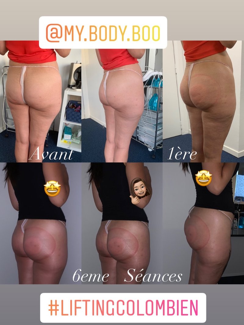 Health body fessier avis hotsell