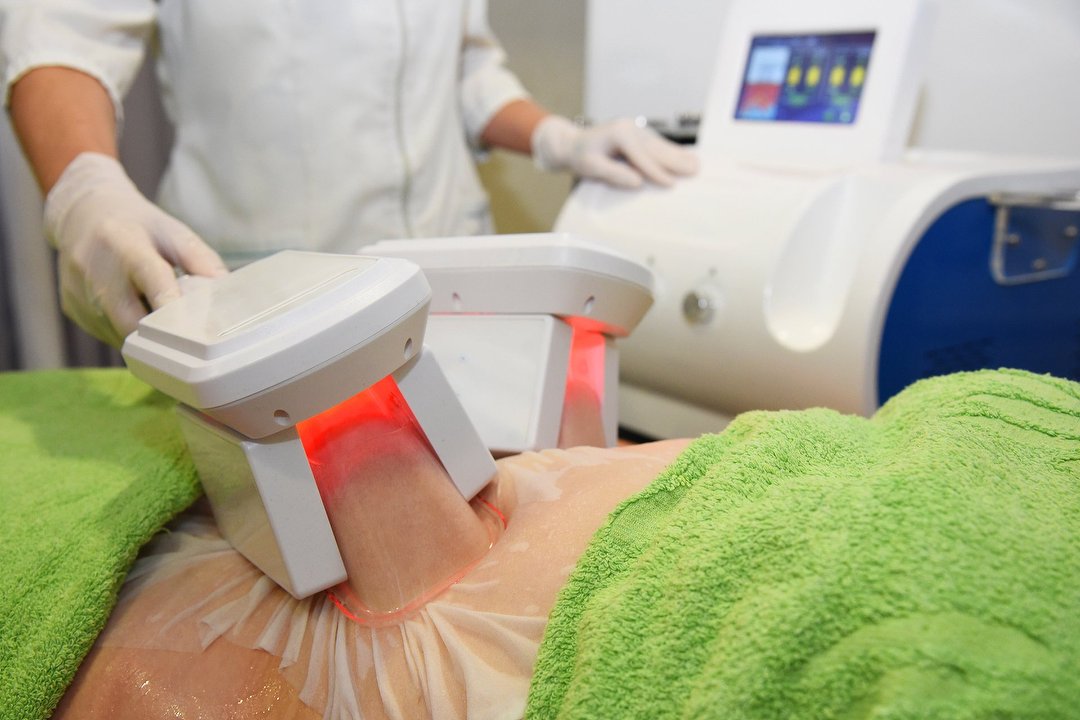 Laser Hair Removal near Southville Bristol Treatwell