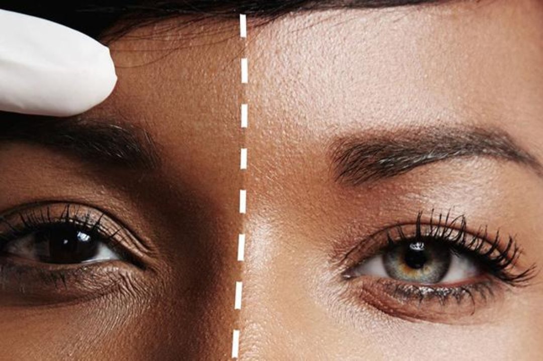 bea Skin Clinic at Charterhouse Clinic, Marylebone, London