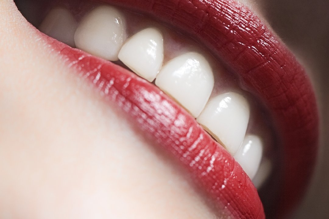 Covent Garden Dental Spa, Covent Garden, London