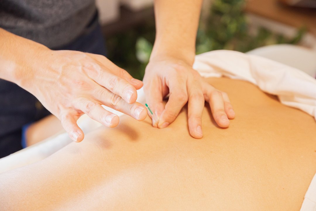 Dynamic Balance Acupunctuur, Burgemeesterswijk/Hoogkamp, Gelderland