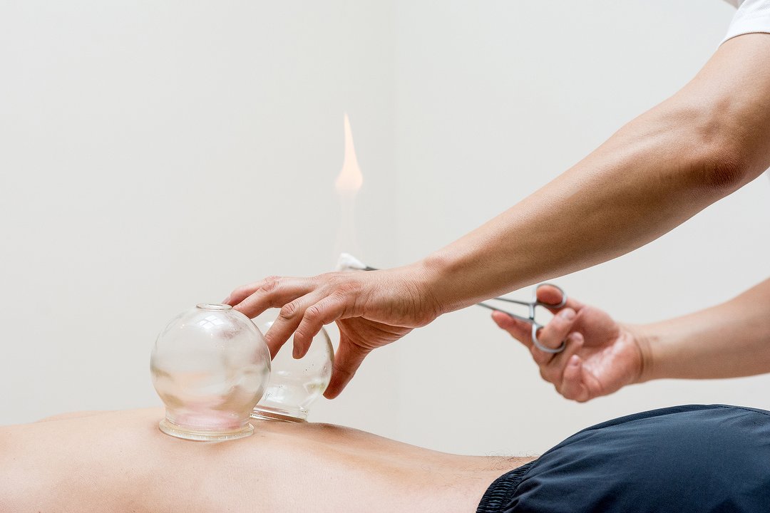 Acupuncture Healing Clinic, Stillorgan, South County Dublin