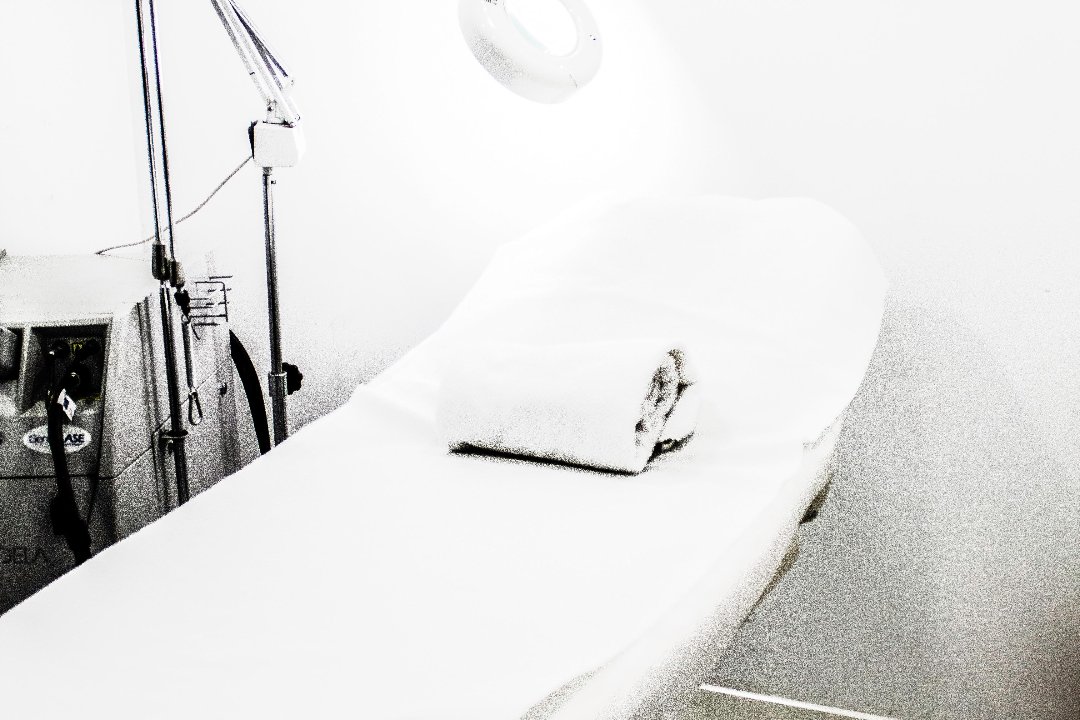 Global Láser, Malasaña, Madrid