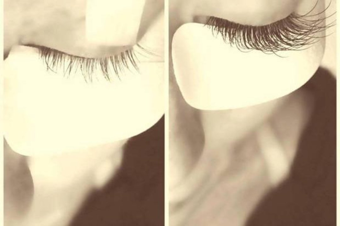 Mycapri, Coronación, Vitoria-Gasteiz