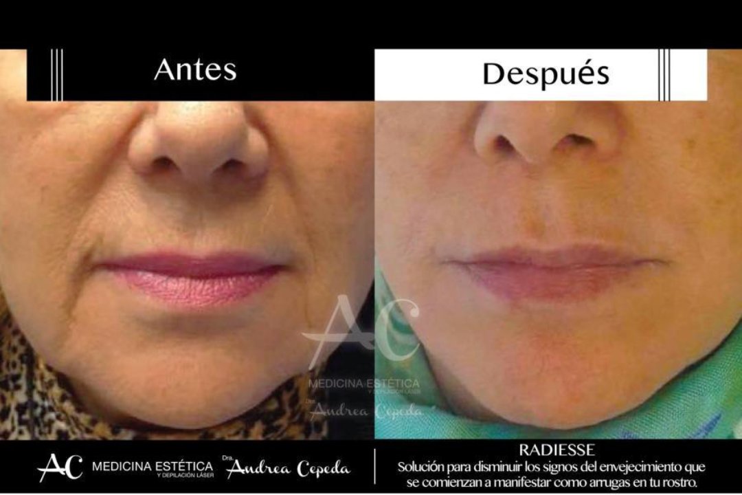 C. Andrea Cepeda Ventas, Concepción, Madrid