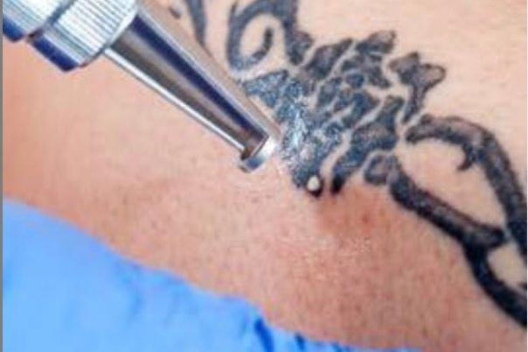 Cris Láser Infinity, Gipuzkoa