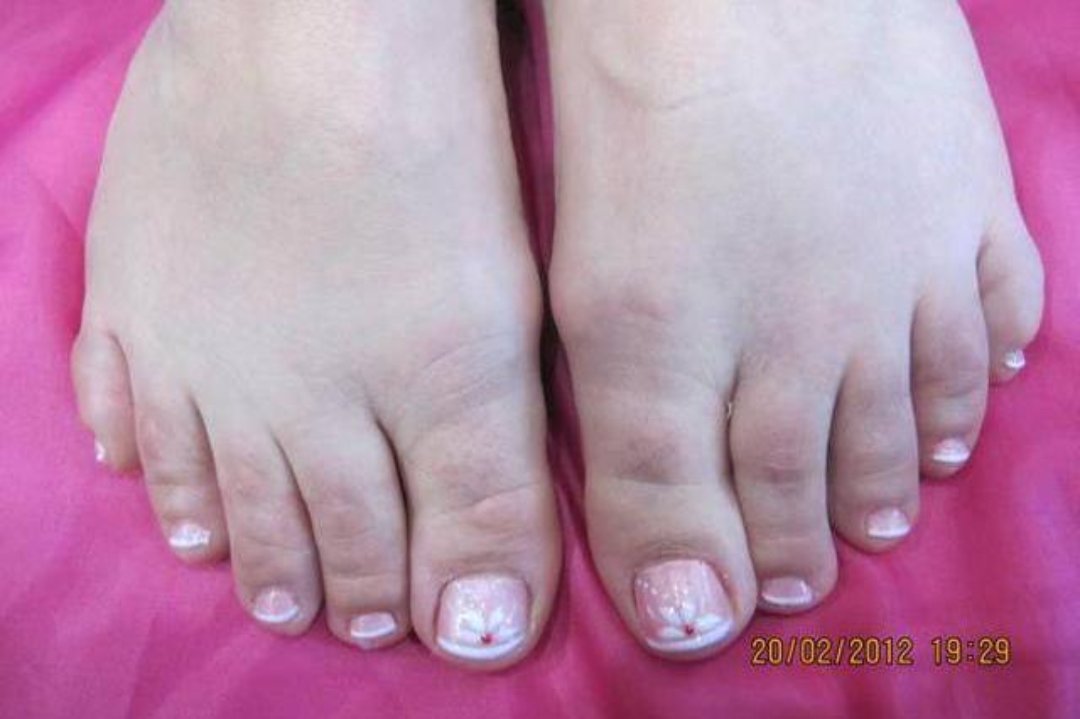 Nuevo Aire, San Ignacio-Elorrieta, Bilbao