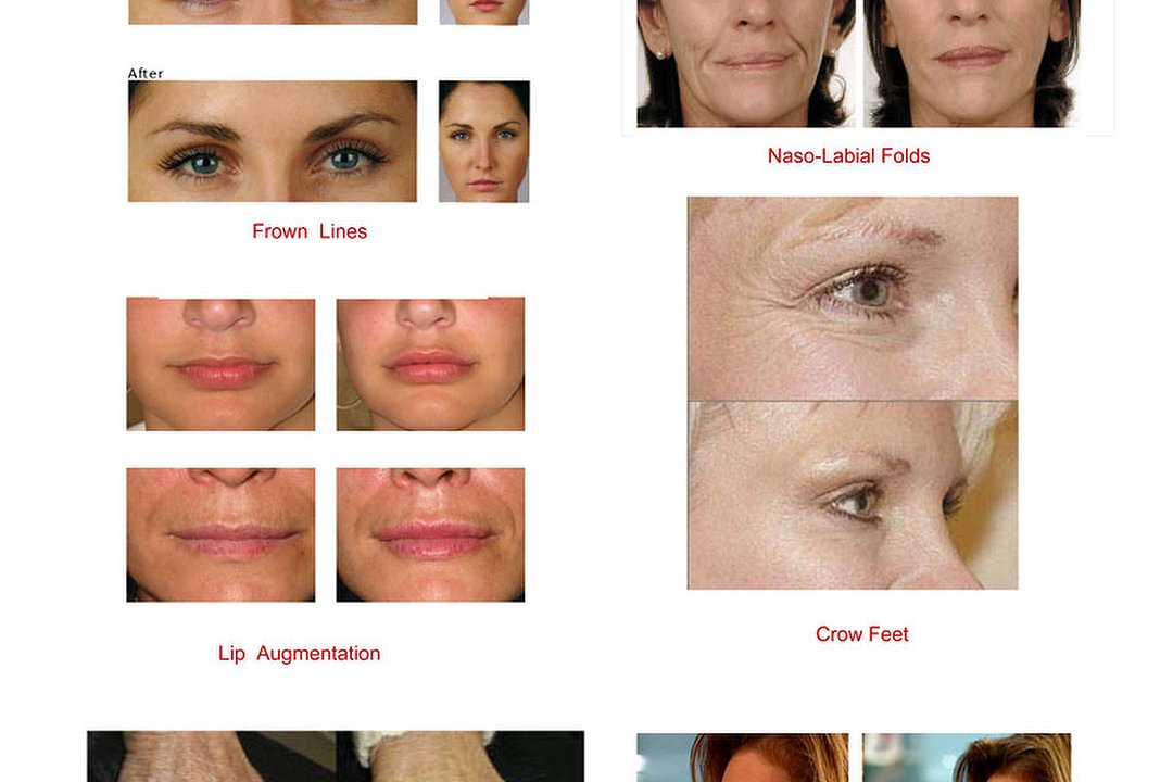 London Beauty Clinic Streatham I, Streatham, London