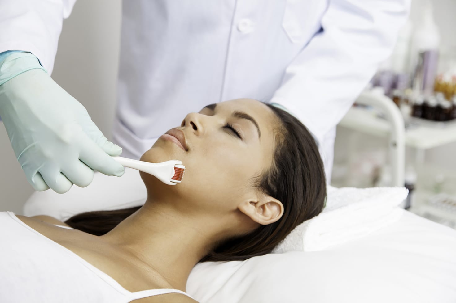 Facials - Micro Needling the right thing for you? Read the guide! - Treatwell
