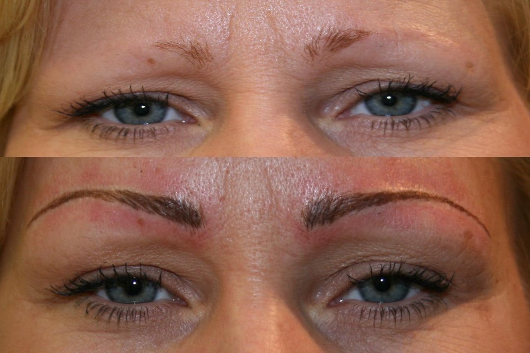 DermaEraze London Branch, Wigmore Street, London