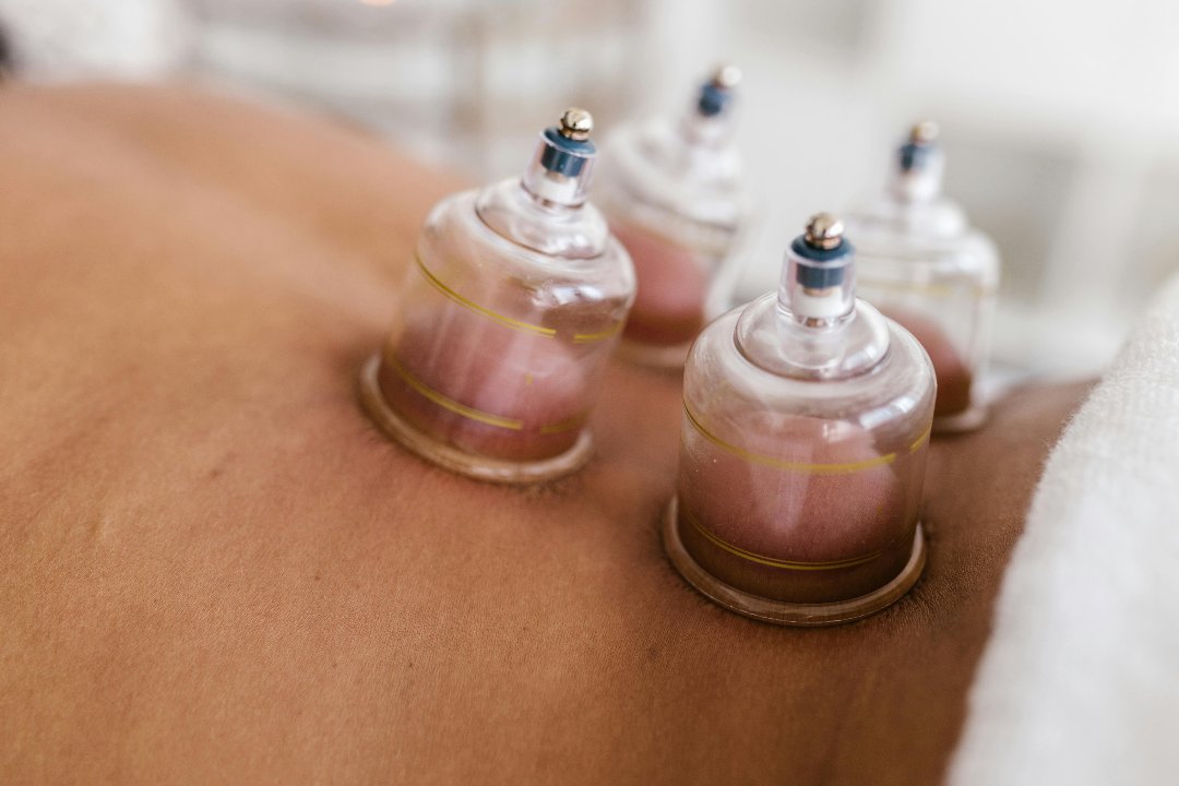 Cupping by Mo, Noord-Holland